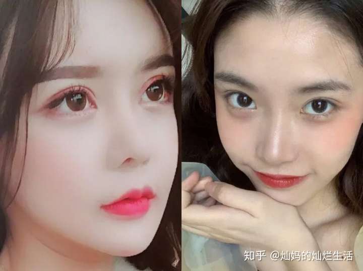 为什么整容一眼就能看出来?