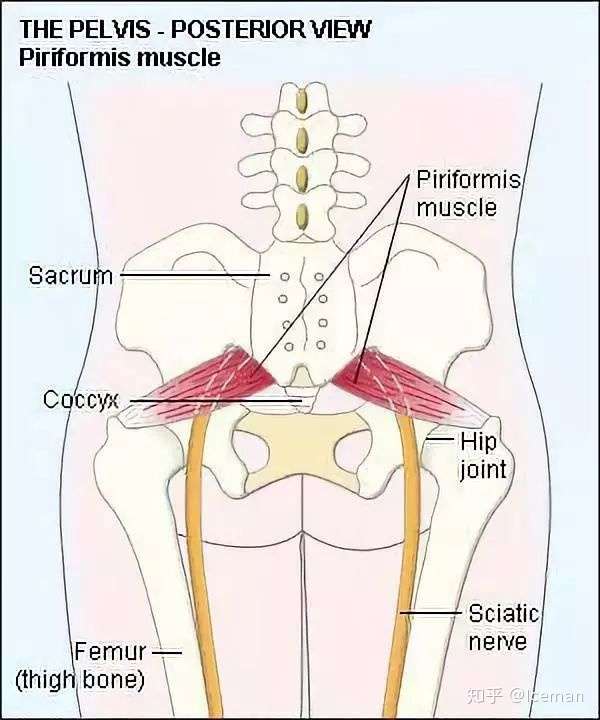 臀部疼痛 腰腿麻木不一定是 腰突 你可能患有梨状肌综合征 知乎