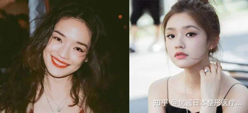 顶着一张 丑美脸 和前夫当街撕逼 离婚后还能被奉为女神的大概只有她了 日本医美 知乎