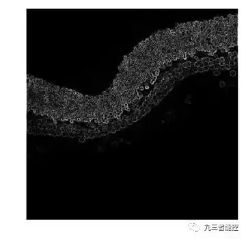 算法集锦(5)|医学图像的边缘检测|Python_边缘检测方法分割医学图像图-CSDN博客