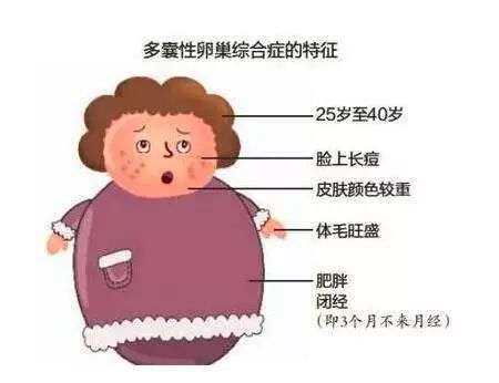明明卵泡很多,偏偏不怀孕是怎么回事呢?插图(1) v2-af57c2aa46dad9005250dc3cf87016b5_720w.png插图(1)