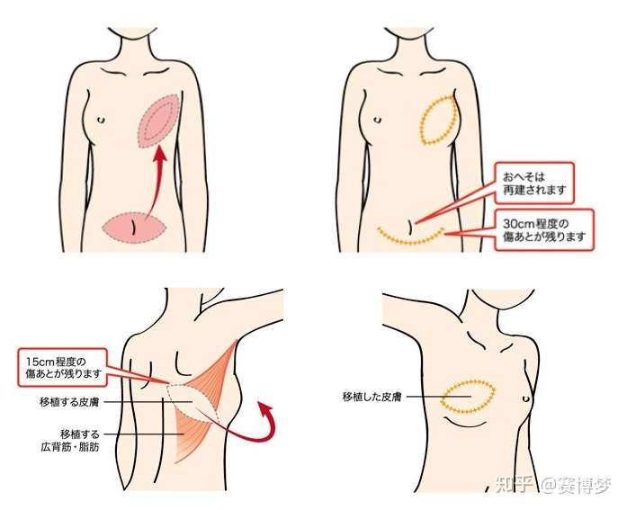 重建女性的魅力 知乎