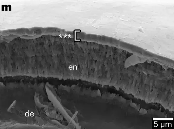 The thickness of the orange coating on the top layer of the crown under an electron microscope