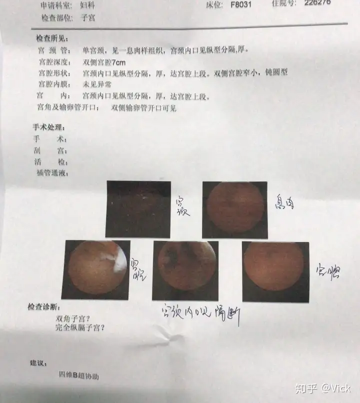 褪成风隔崔神(图1)