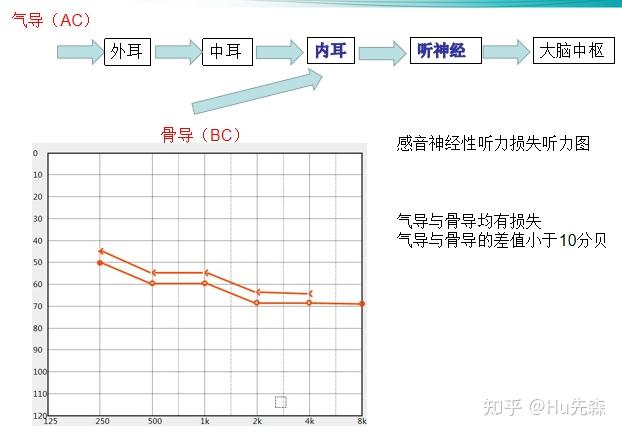 神经性耳聋需要助听器吗?