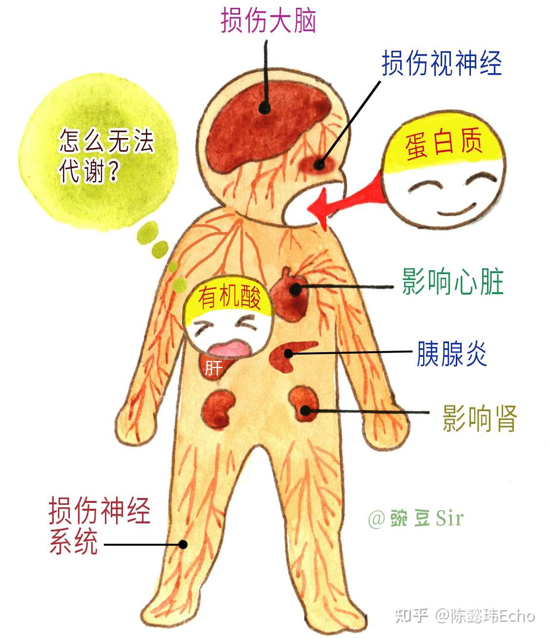 甲基丙二酸血症 生命不能承受的蛋白质之重 生而不凡 知乎