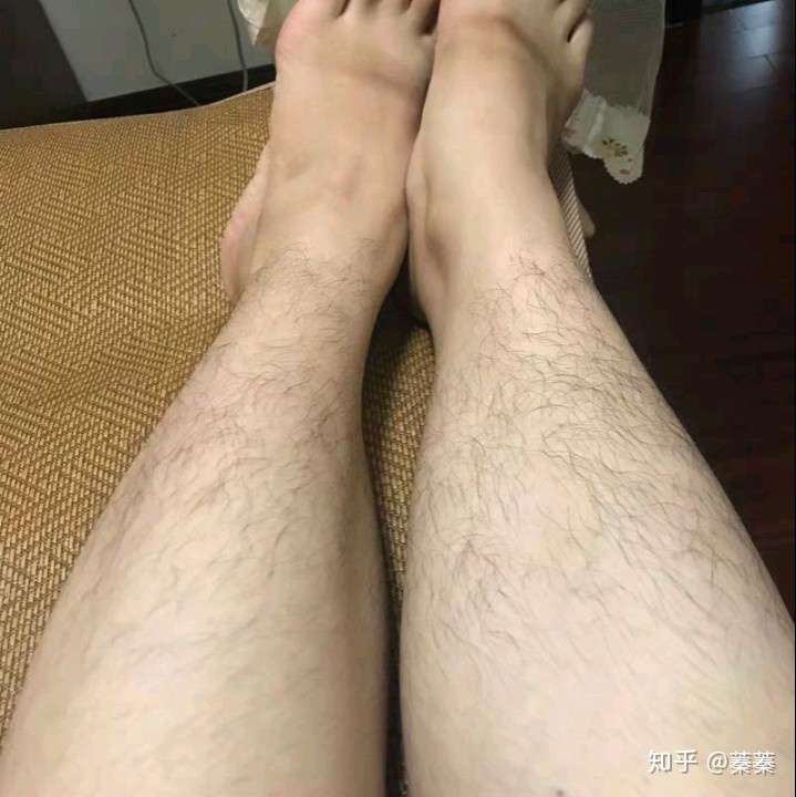现在女生手上腿上有汗毛的多吗?大家会自卑吗?