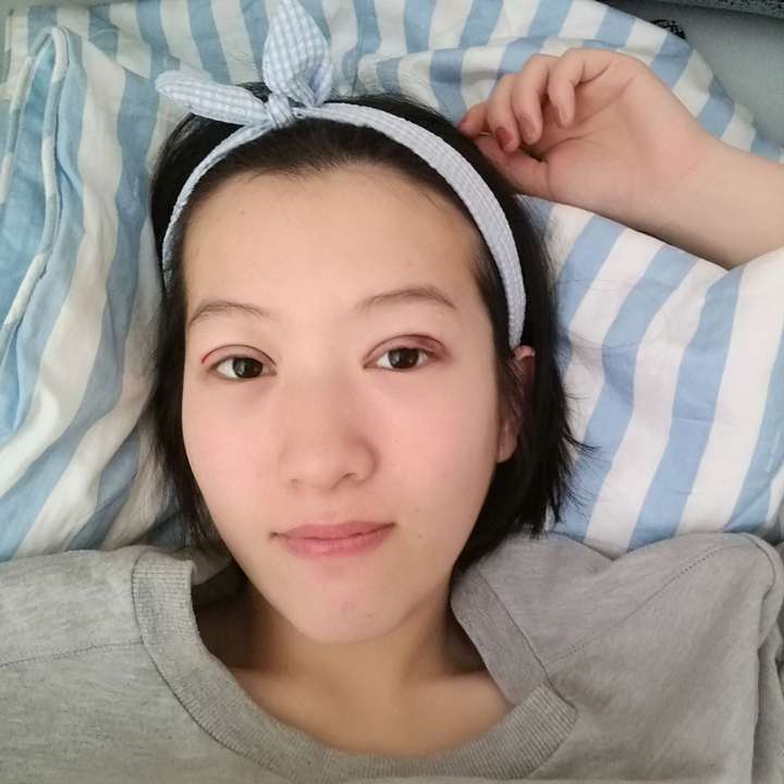 割双眼皮对外貌的改变大吗？