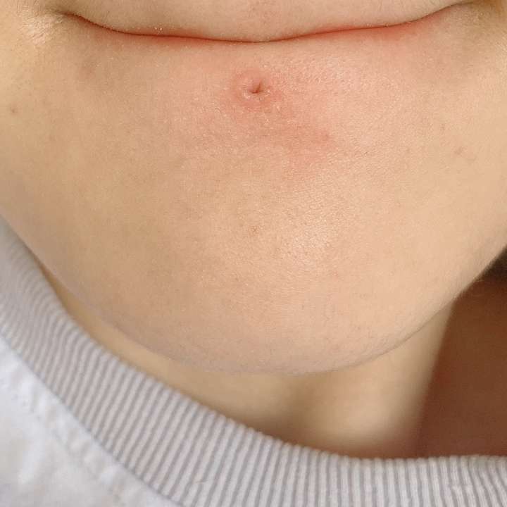 我想看看唇钉摘下后是什么样子的