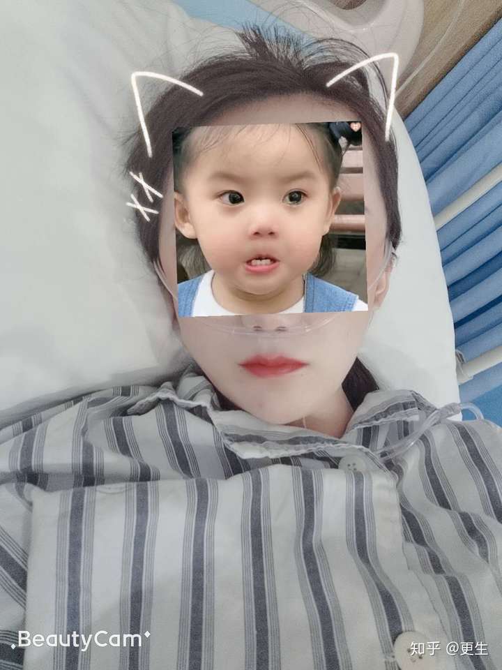 痔疮手术到底有多痛苦90后女生术后70天的分享一