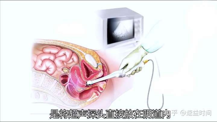 妇科检查有哪些项目必做呢大概多少钱