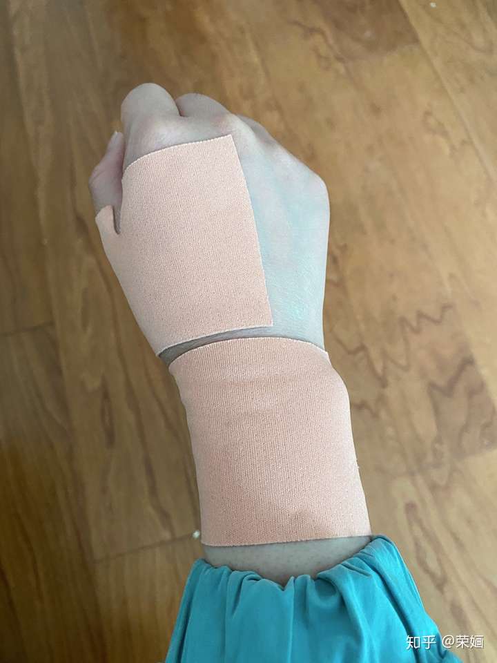 腱鞘炎能自愈吗