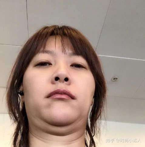 脸颊不胖不瘦但下巴肉堆了很多肉有双下巴怎么去双下巴有什么好的方法