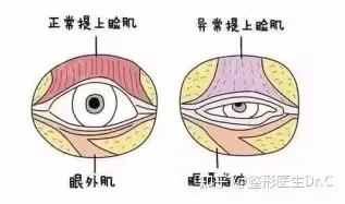 上唇提肌图片