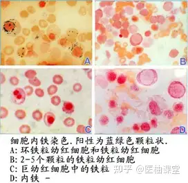 外周血涂片染色图片