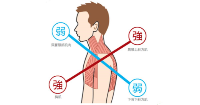 圓肩是什麼意思怎麼解決