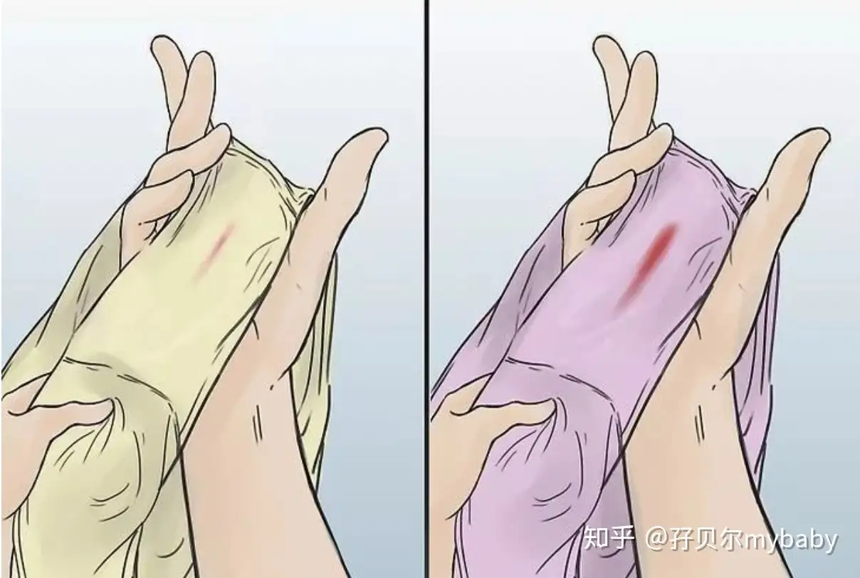 怀孕有一种神奇 叫着床出血 知乎