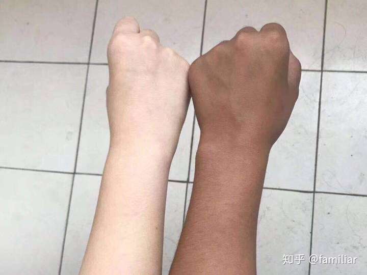 有没有晒黑后 美白的方法啊?