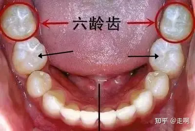 牙齿六龄齿位置图片图片