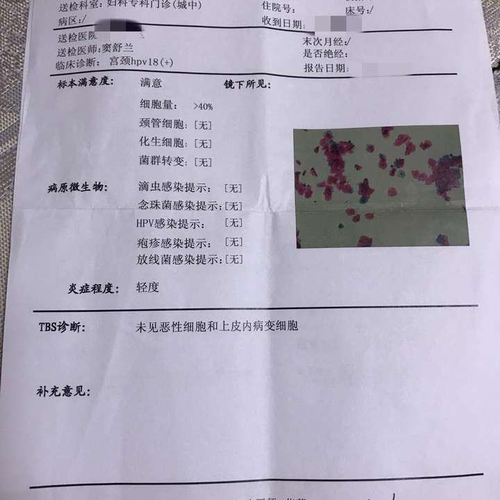 打hpv九价前检查出来hpv18阳性