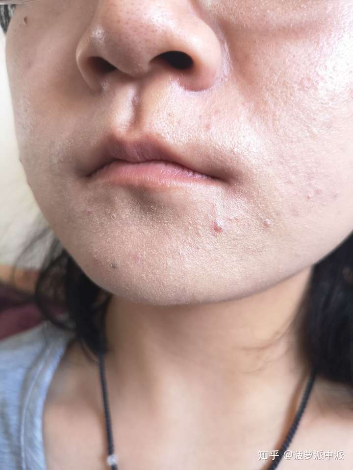 底妆斑驳长什么样?