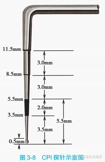牙周探针刻度示意图图片