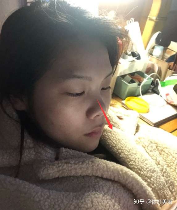 我是属于朝天鼻吗?