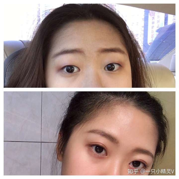 单眼皮好看?还是双眼皮好看?