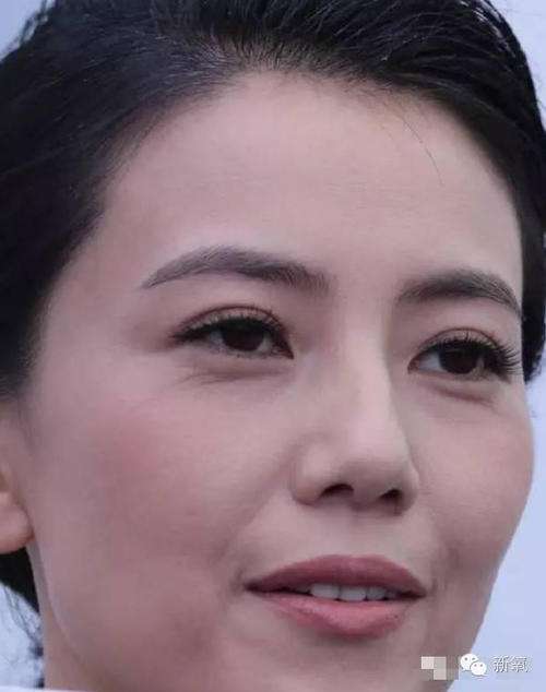 医美的效果强大到真的会上瘾(图48) 医美的效果强大到真的会上瘾(图54)