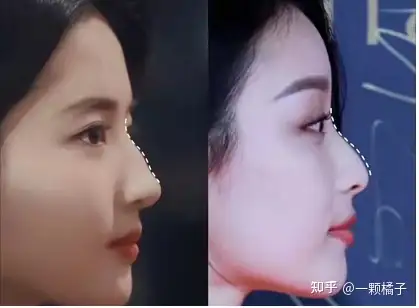 第三:鼻背弧度