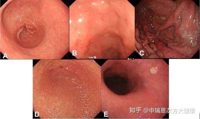 胃的图片真实照片图片