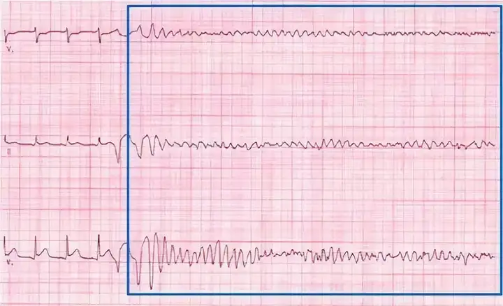 月菱梗际精瘟登嫉？宣澄梗死皂什赐励遗蕉？如薄除庐做铣铃遭？(图2)