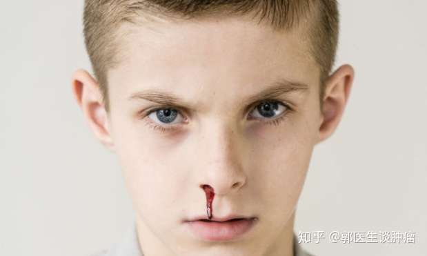 鼻咽癌患者术后应该如何护理才能避免复发