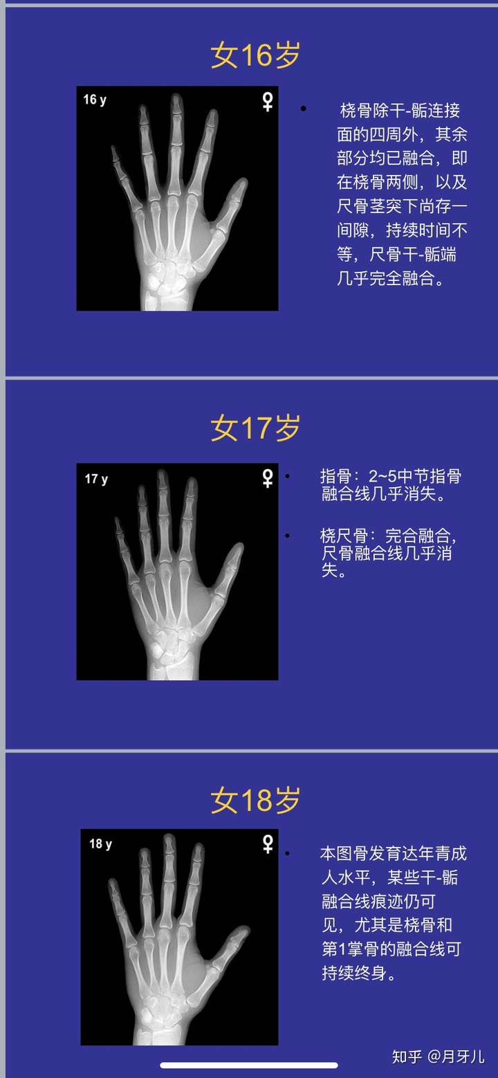 怎麼說服父母同意去測骨齡