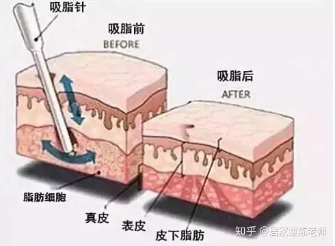 一看就會(huì)（目前市面上減肥效果最好的減肥藥）市面上什么減肥藥既安全又方便有效，市面上減肥方法總結(jié)，侯府姨娘想要個(gè)孩子，