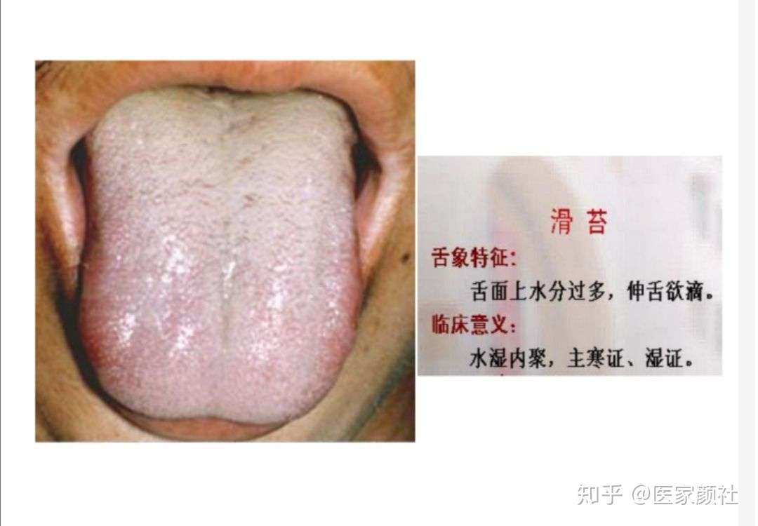 如何通过舌苔来判断身体健康与否 最全舌像来了 一分钟教你学会所有舌像 知乎 如何通过舌苔来判断身体健康与否 最全舌像来了 一分钟教你学会所有舌像 知乎