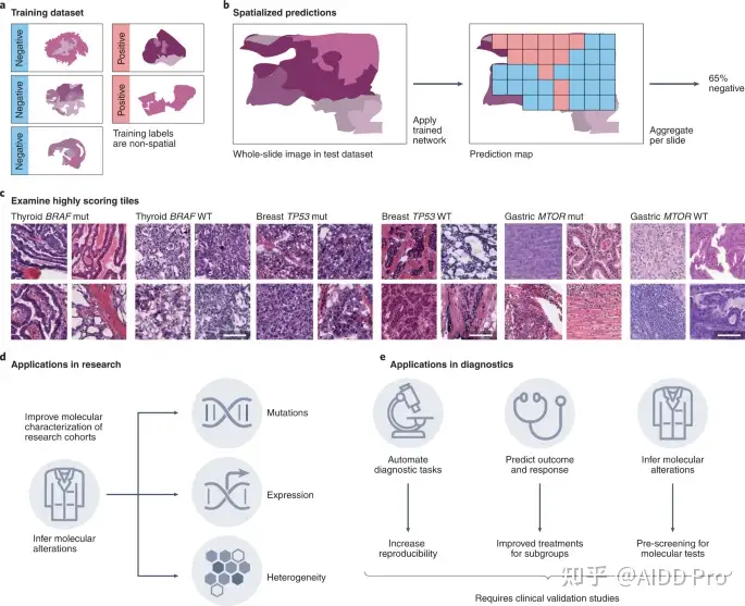 Nature综述：AI在肿瘤组织病理学中的应用- 知乎