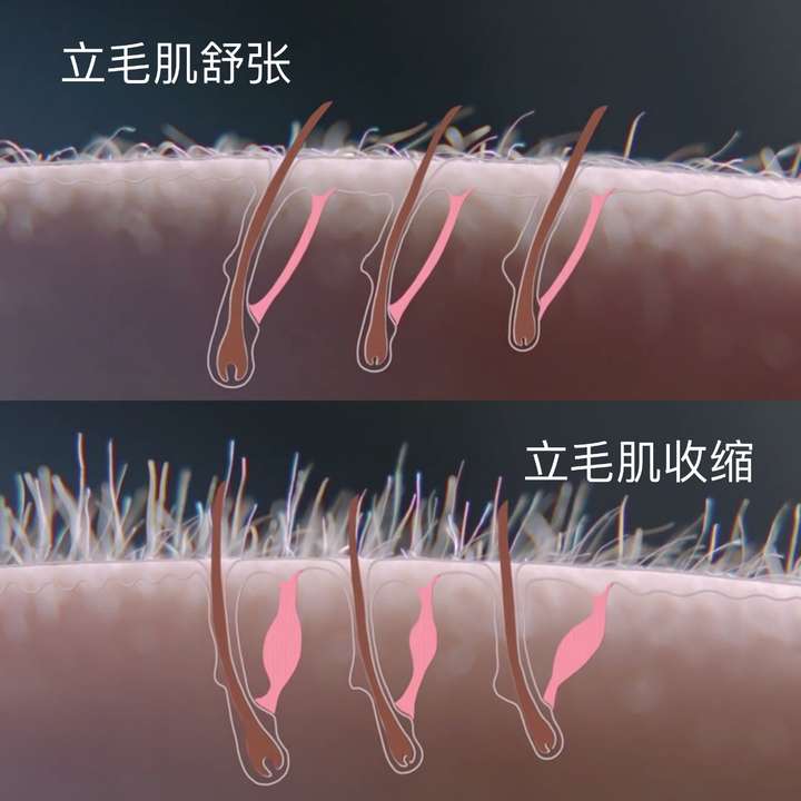 身上无缘起鸡皮疙瘩(身上无缘起鸡皮疙瘩痒)