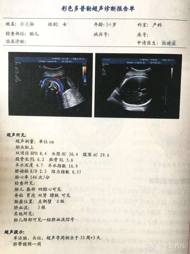 孕期5次b超何时做 查什么 结果怎么看读懂这篇就明白了 知乎