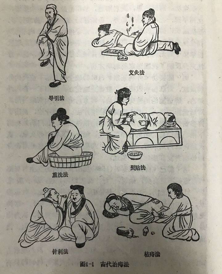 古代人得痔疮怎么搞?