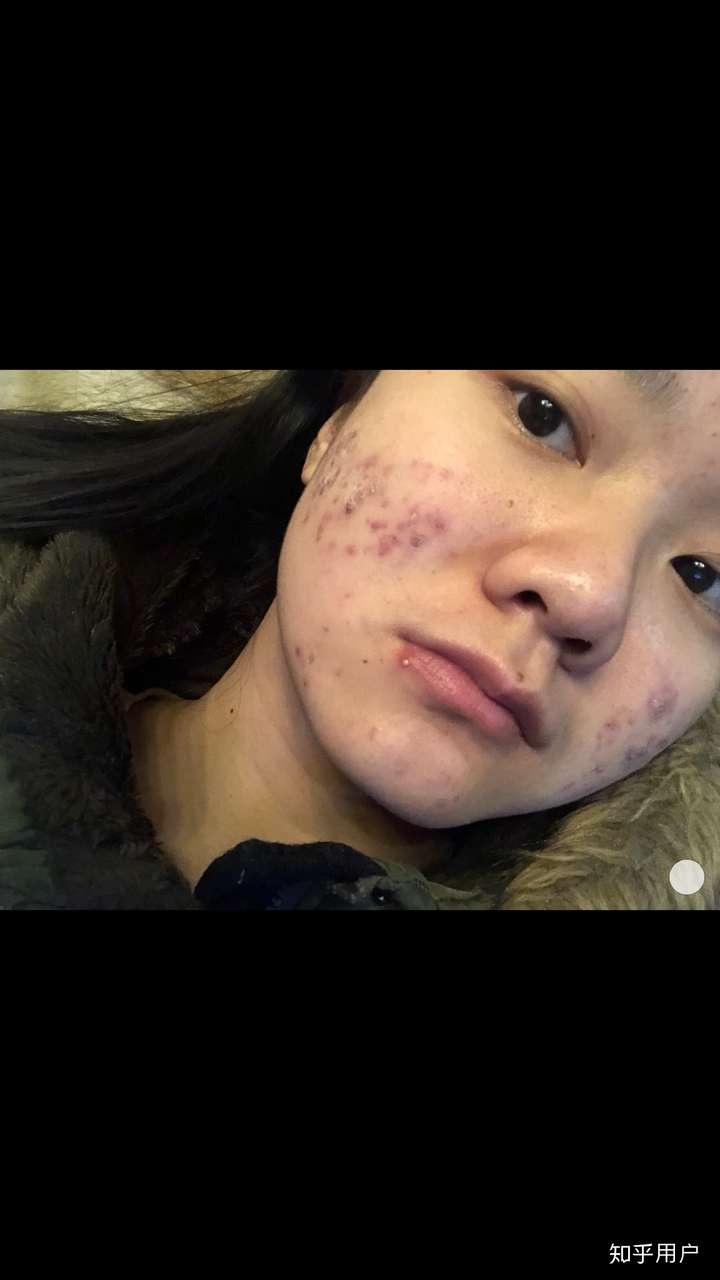 女生胖又难看是种怎样的体验?