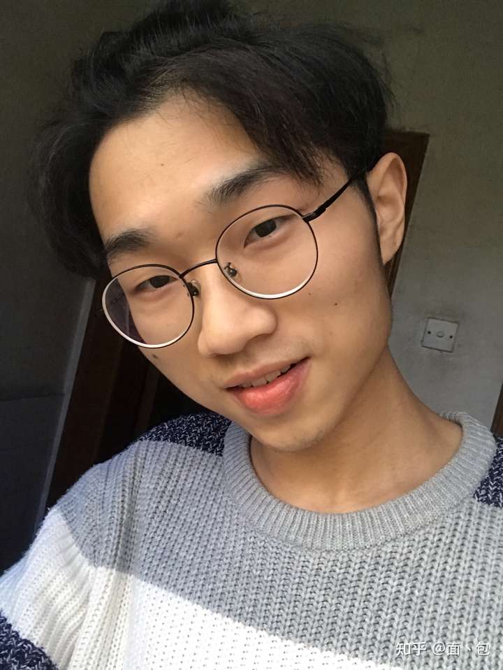 男生长得丑还留长发是什么体验?