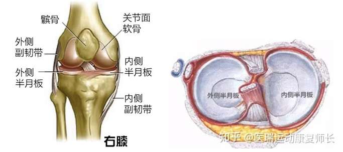 半月板损伤的原因图片