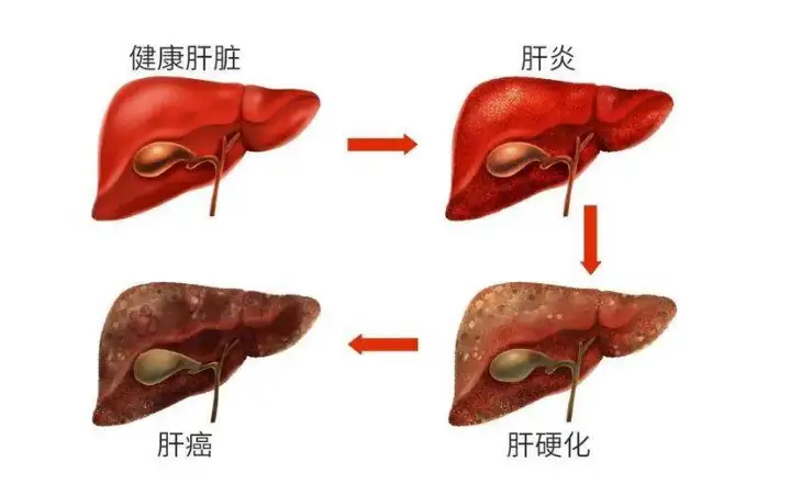 身上这2处发痒 或许不是皮肤过敏 而是肝癌找上门了 请及时检查 知乎