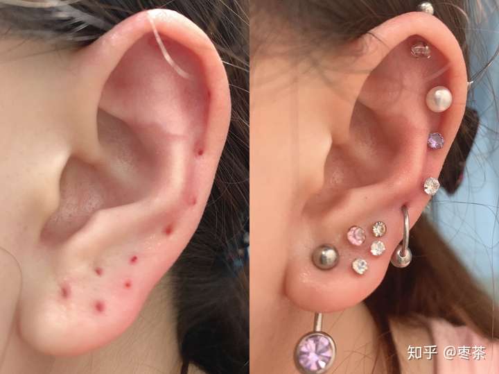 2020年4月下旬最新款耳朵来更新一下 半个多月前开始右边扩耳了,现在