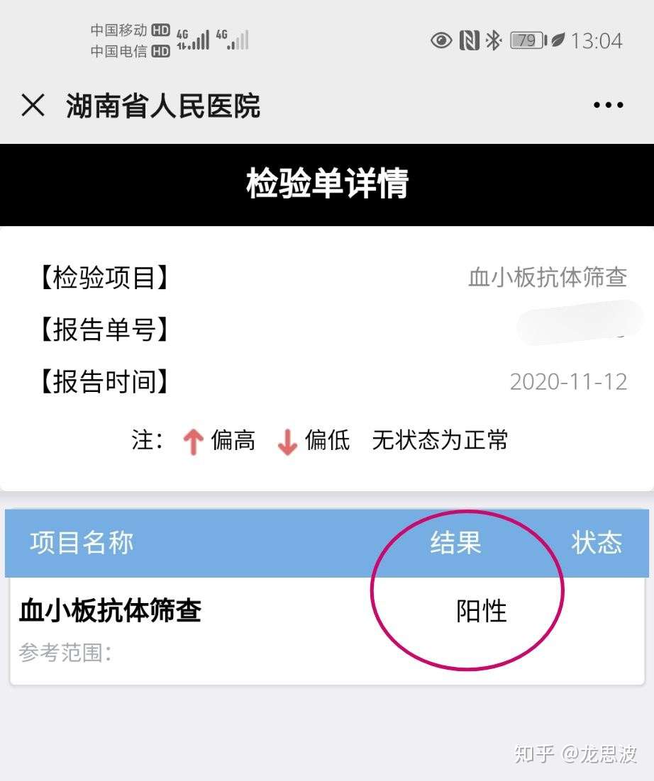 记录mds Eb2急转髓系白血病历程和一些注意事项 知乎