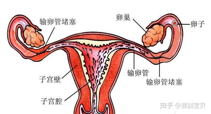 引发宫外孕,输卵管为何从来不讲武德?插图(1) v2-d90d14d12f3162ecde3e360a38a8ad5f_720w.jpg插图(1)