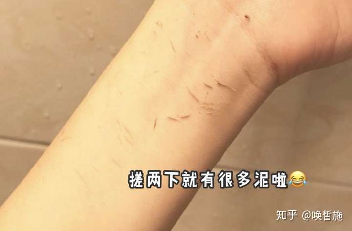 徒手去鸡皮肤方法(去鸡皮肤最有效的方法一定要)