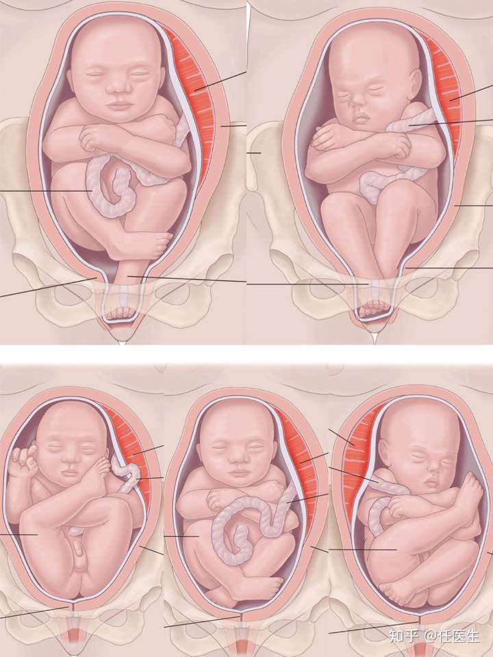 36周胎儿真实图片图片