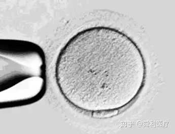 纺锤体是存在于卵子中的对染色体分配和细胞分裂起着至关重要作用的小
